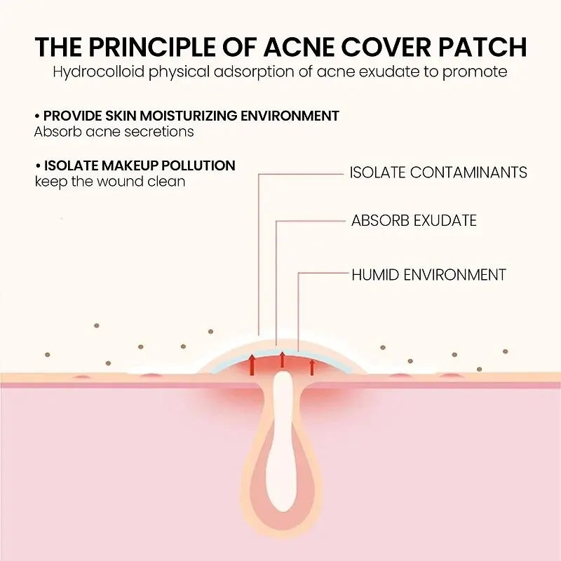 Acne Repair Patches – Fast Healing for Pimples, Blemishes & Marks