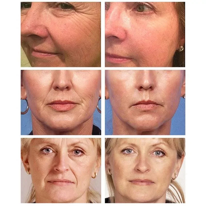Golden Age Pomegranate & Hyaluronic Acid Wrinkle Removal Serum