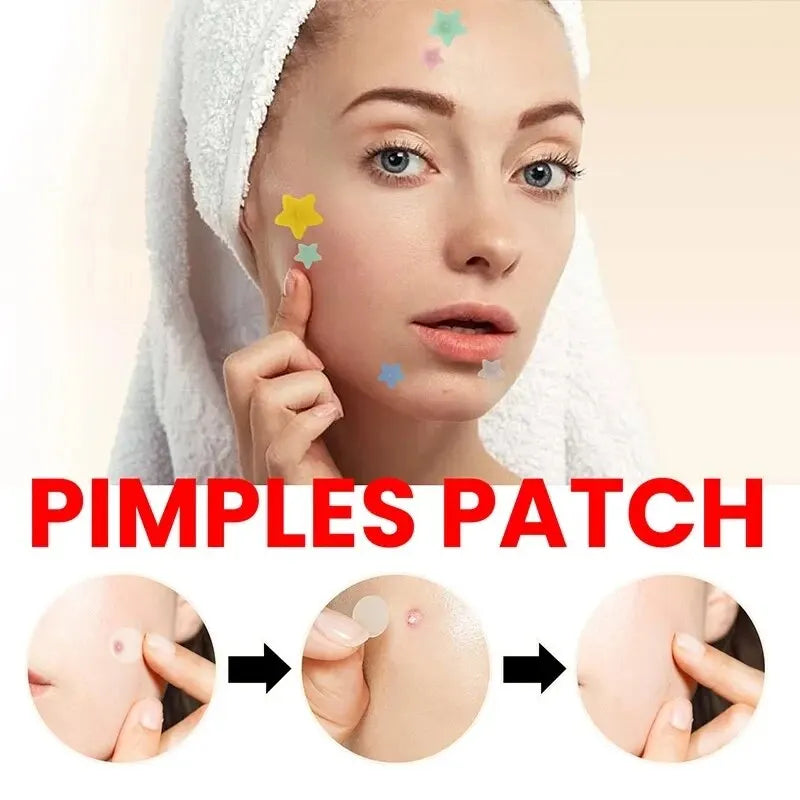 Acne Repair Patches – Fast Healing for Pimples, Blemishes & Marks