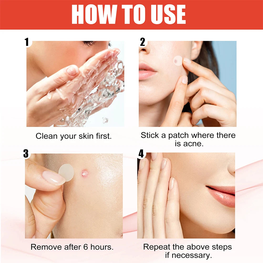 144PCS Invisible Hydrocolloid Acne Pimple Patch Set – Fast Healing Spot Stickers for Men & Women