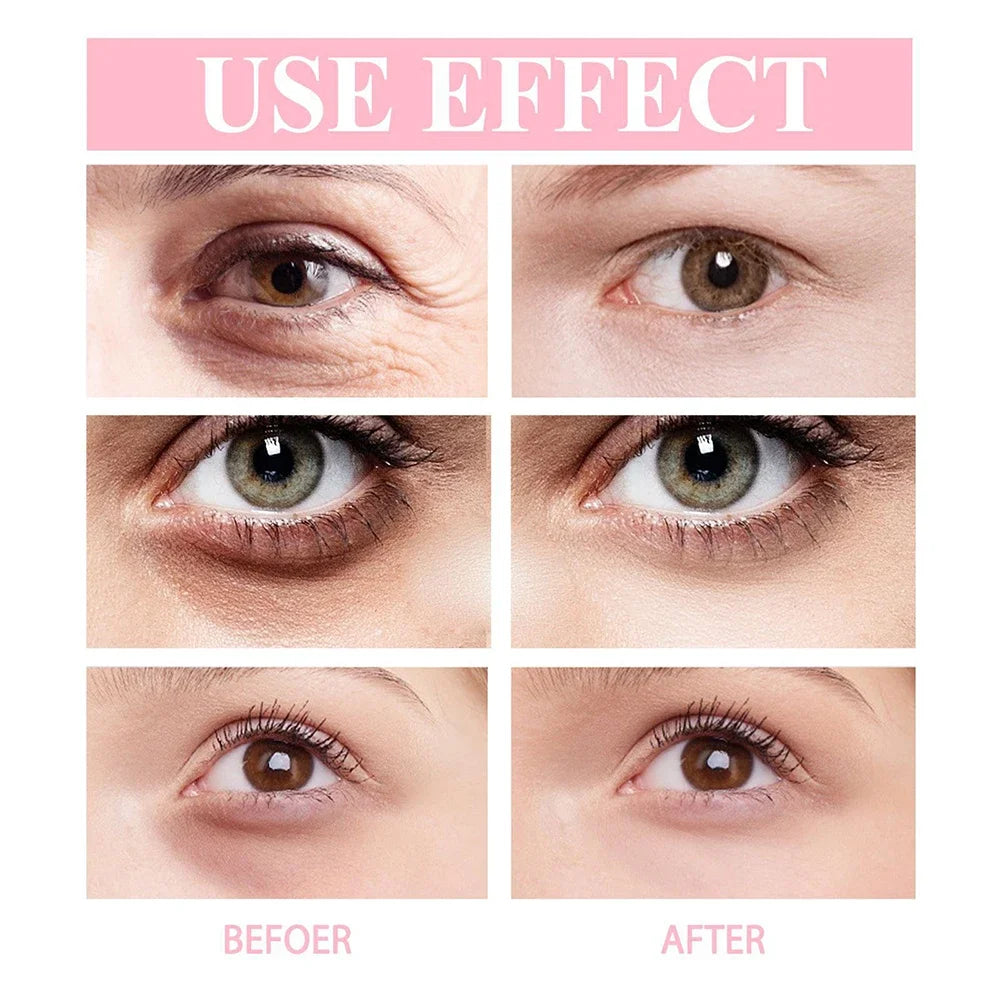 Anti-Aging Retinol Eye Stick – Fades Fine Lines & Puffiness Instantly