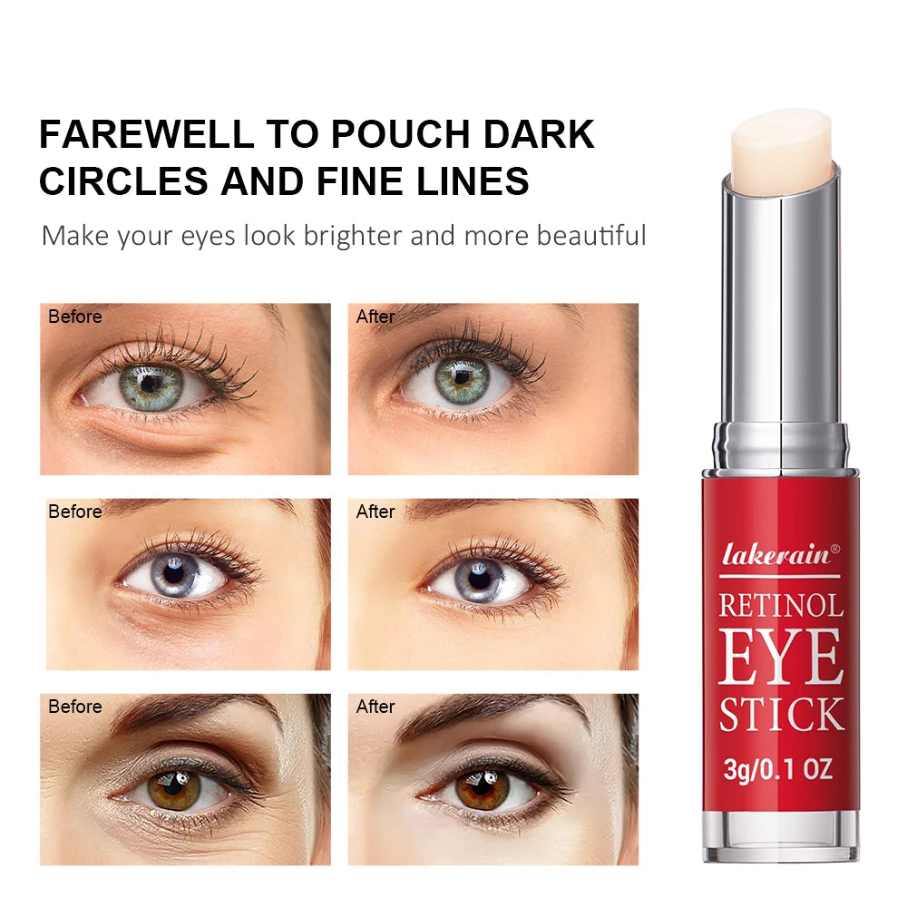Lakerain Anti-Aging Retinol Eye Cream Stick – Anti-Wrinkle, Dark Circles & Eye Bag Removal