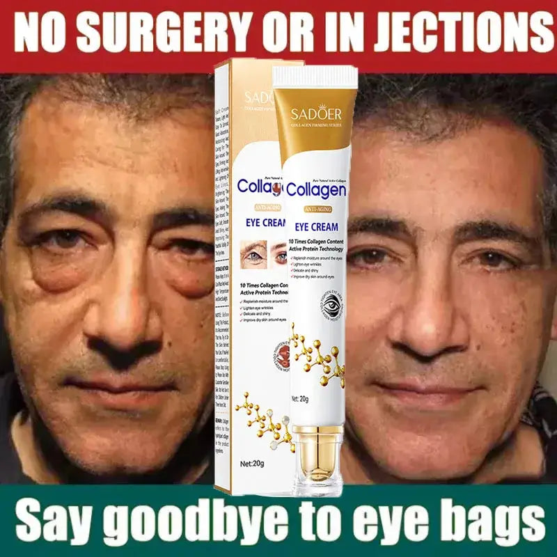 SADOER Collagen Eye Cream – Anti-Dark Circles & Eye Bag Removal
