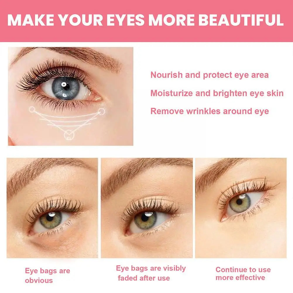 Rosehip Eye Cream Stick – Dark Circle Remover,, Eye Bag Remover, Lift, Moisturize & Brighten Eyes