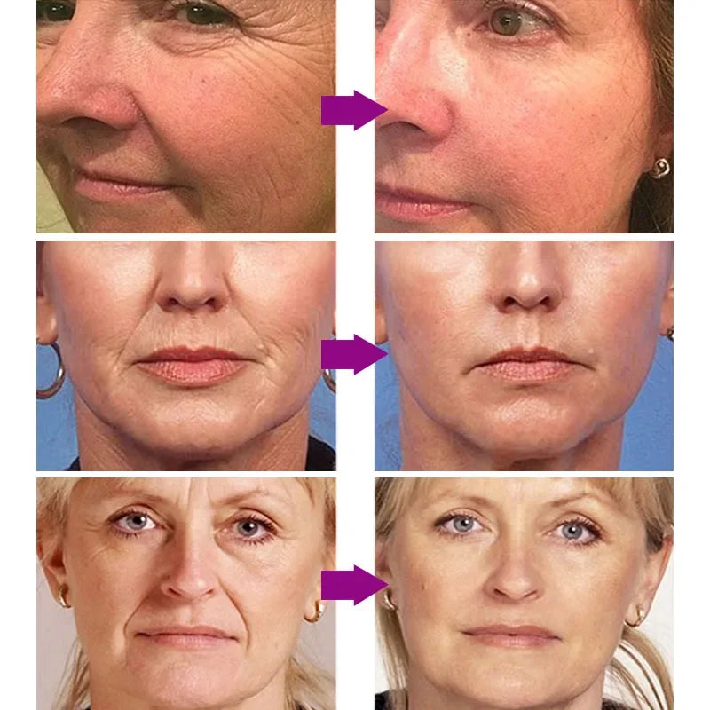Retinol Anti-Aging Serum, Eye Stick & Wrinkle Repair Face Set for a Youthful Look