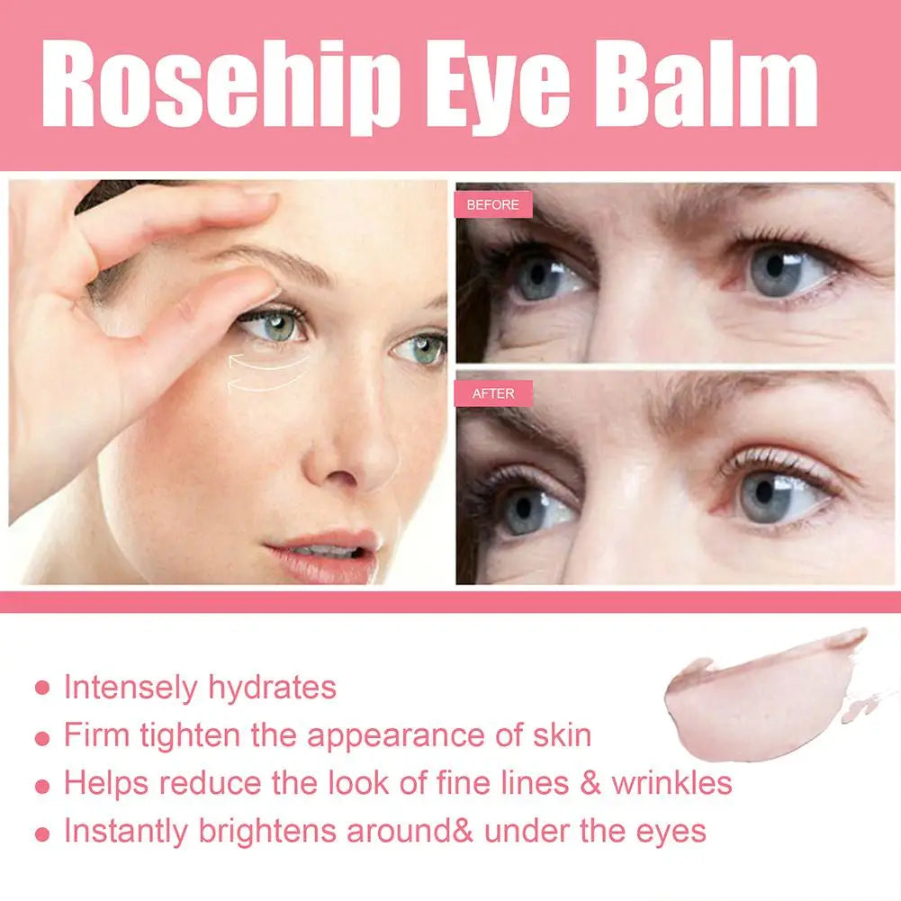Rosehip Eye Cream Stick – Dark Circle Remover,, Eye Bag Remover, Lift, Moisturize & Brighten Eyes