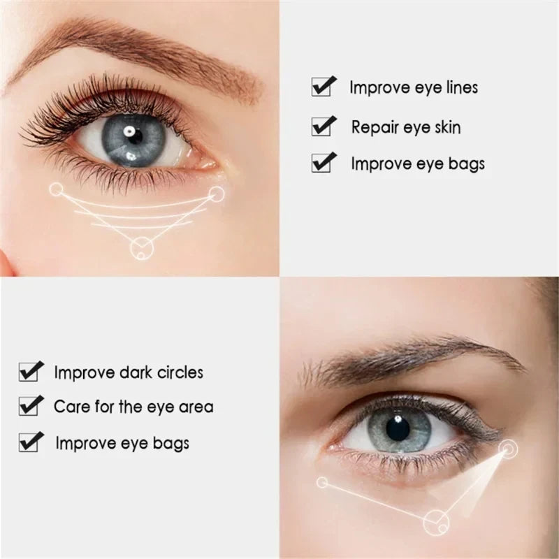 Nicotinamide Eye Cream – Dark Circle, Wrinkles , Puffiness & Eye Bag Remover