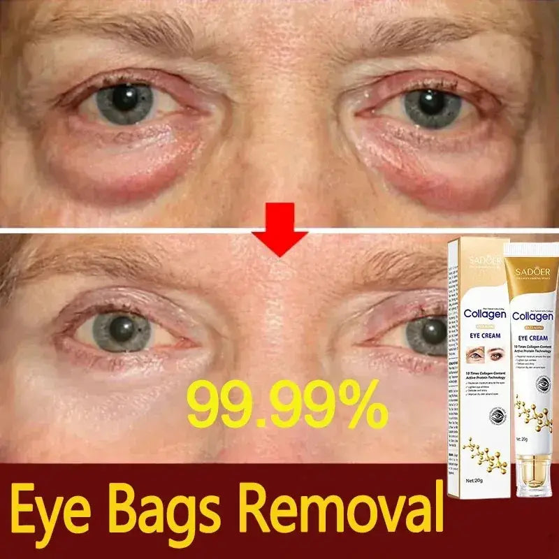 SADOER Collagen Eye Cream – Anti-Dark Circles & Eye Bag Removal