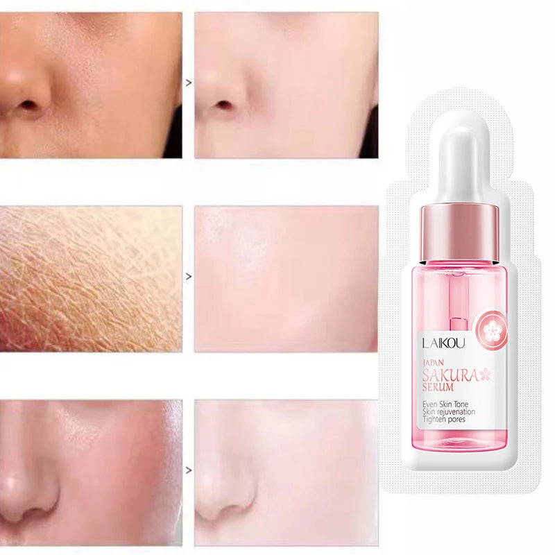 ๐ธ Sakura Face Serum โ Brighten Your Skin , Moisturizes, Anti-Wrinkle & Smooth Fine Lines