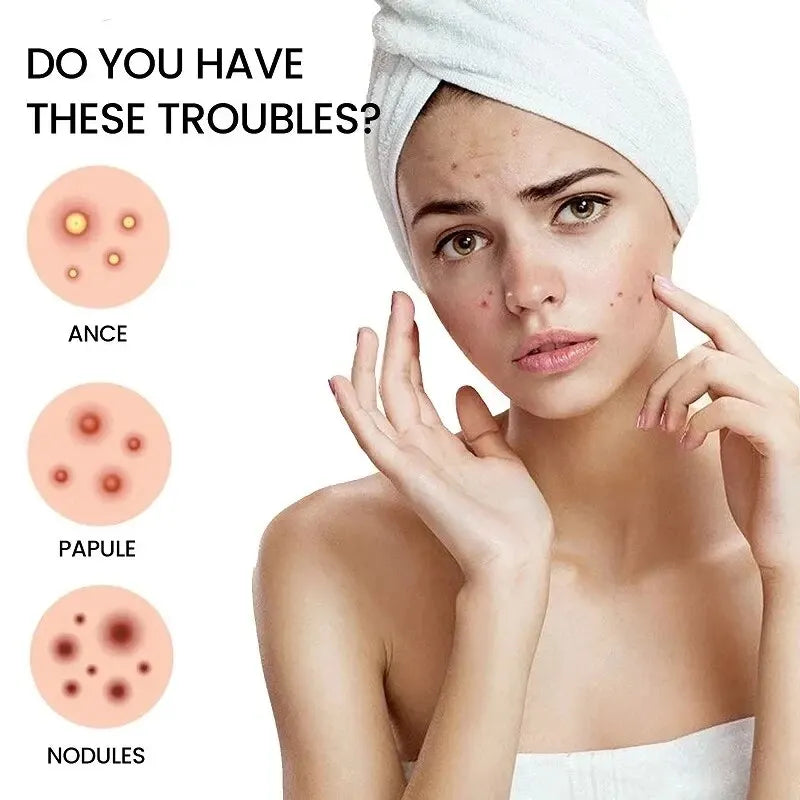 Acne Repair Patches – Fast Healing for Pimples, Blemishes & Marks