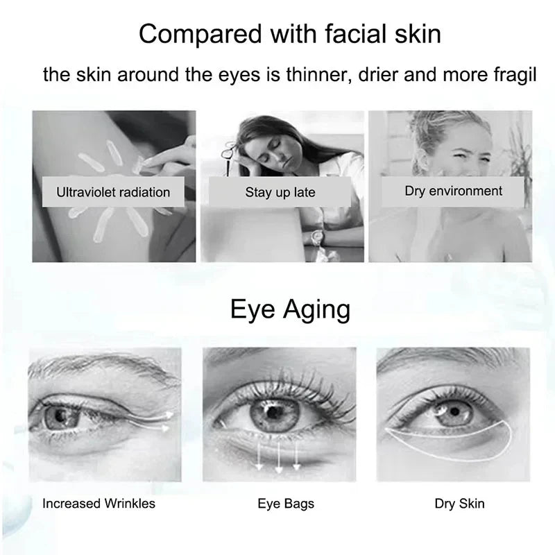 Nicotinamide Eye Cream – Dark Circle, Wrinkles , Puffiness & Eye Bag Remover