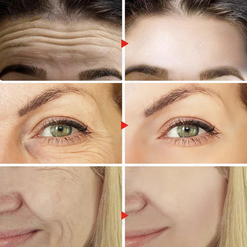 Retinol Anti-Aging Serum, Eye Stick & Wrinkle Repair Face Set for a Youthful Look