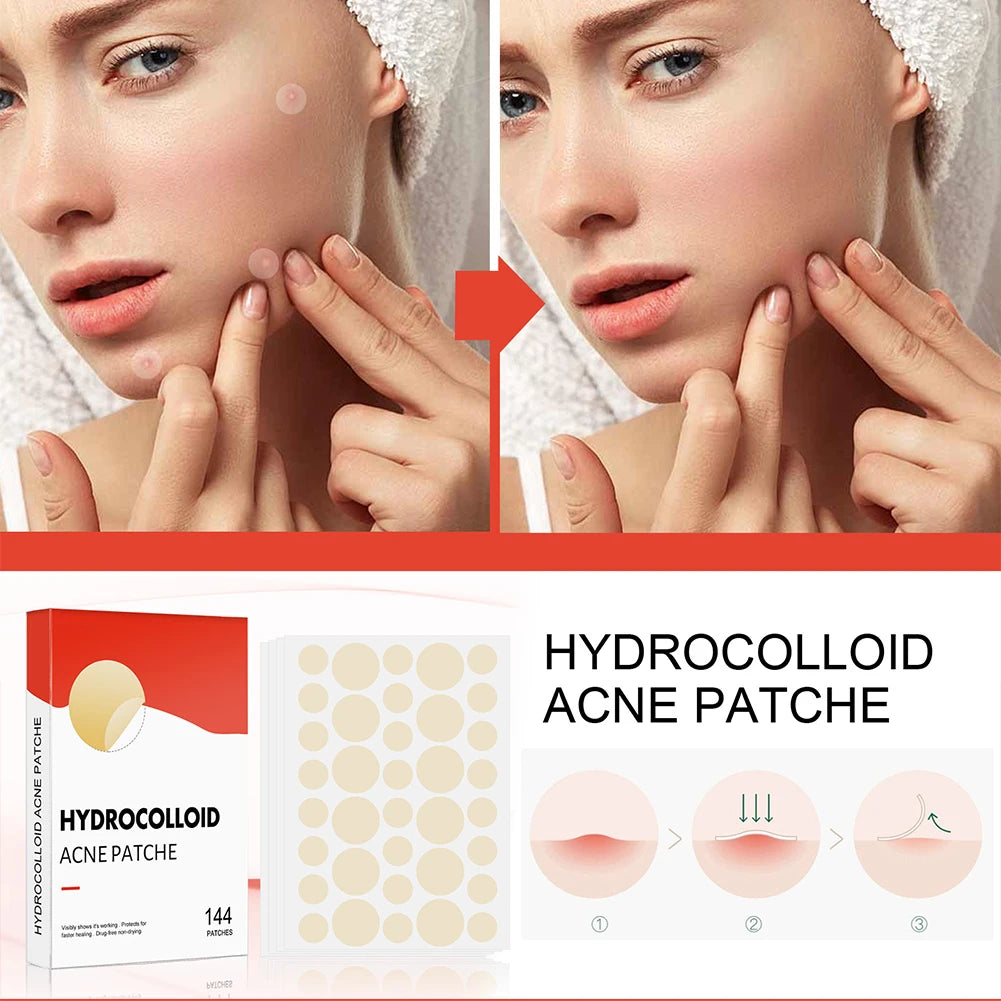 144PCS Invisible Hydrocolloid Acne Pimple Patch Set – Fast Healing Spot Stickers for Men & Women