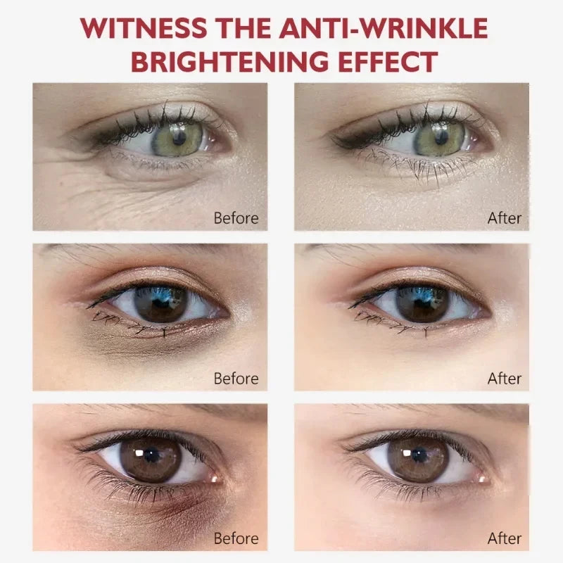 Nicotinamide Eye Cream – Dark Circle, Wrinkles , Puffiness & Eye Bag Remover