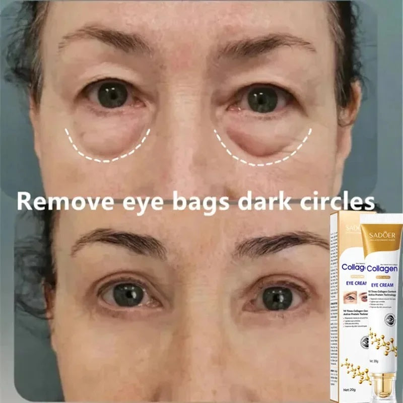 SADOER Collagen Eye Cream – Anti-Dark Circles & Eye Bag Removal