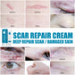 Herbal Scar Removal Cream