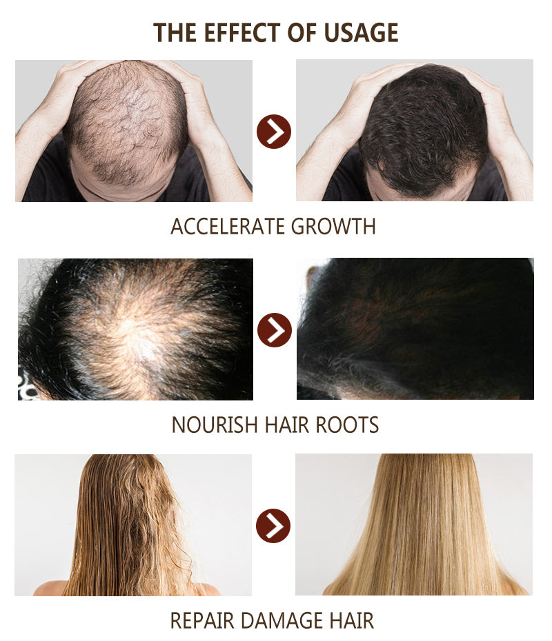 Hair Growth Serum Spray