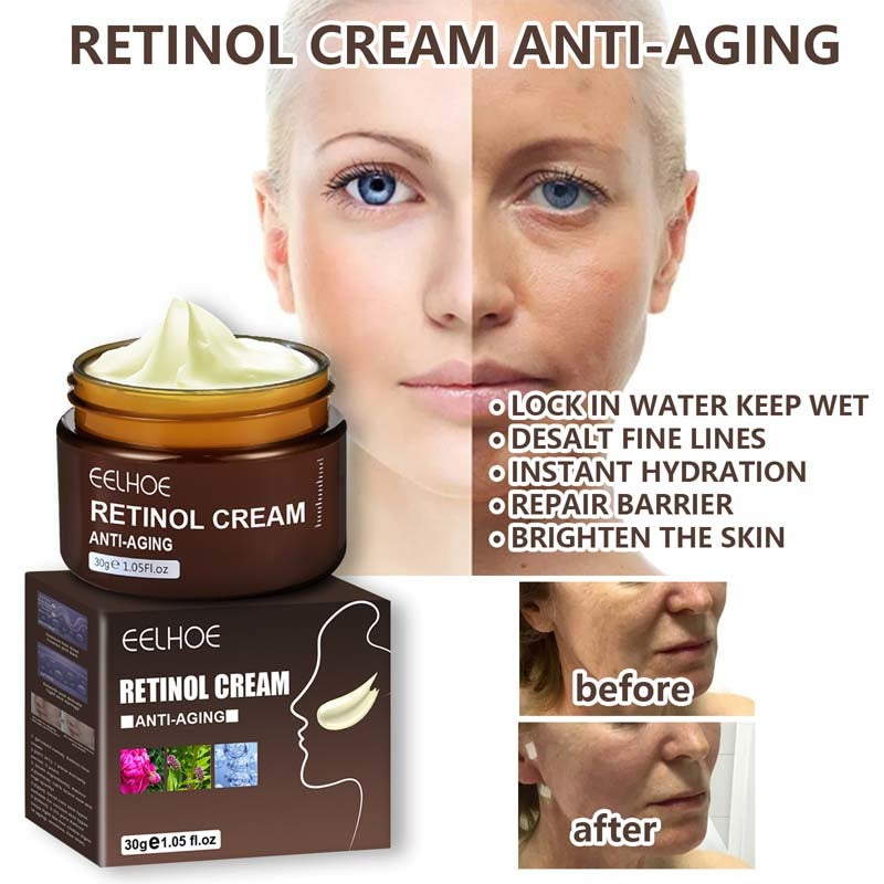 Retinol Wrinkles Removal Cream