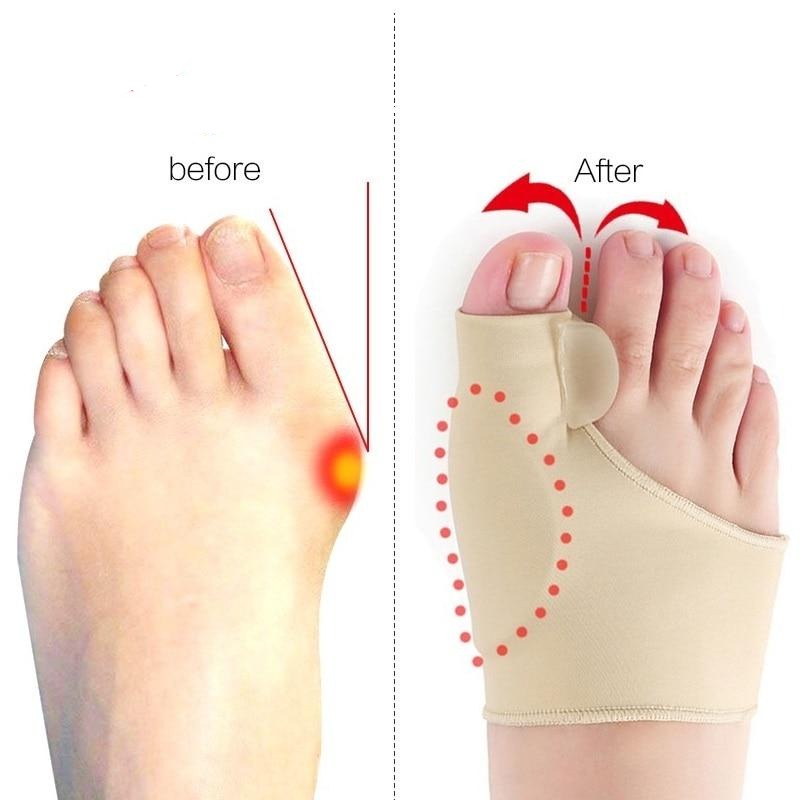 Big Toe Splint Separator Bunion Corrector