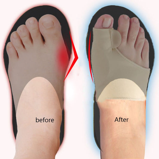 Big Toe Splint Separator Bunion Corrector