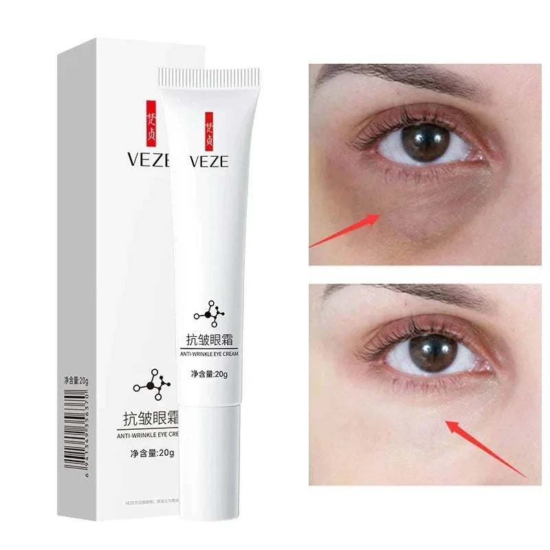 Nicotinamide Eye Cream – Dark Circle, Wrinkles , Puffiness  & Eye Bag Remover