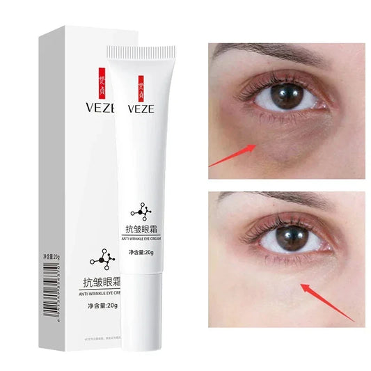 Nicotinamide Eye Cream – Dark Circle, Wrinkles , Puffiness  & Eye Bag Remover