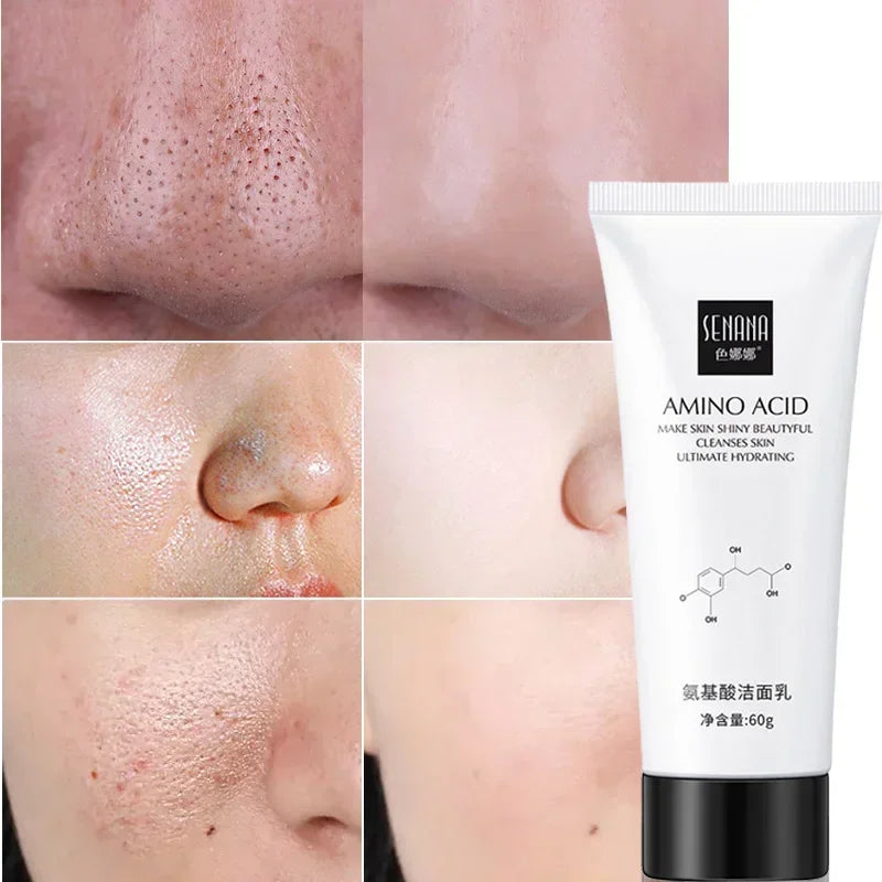 Nicotinamide Amino Acid Face Cleanser - Deep Cleansing , Shrink Pores & Oil Control for Clear Skin