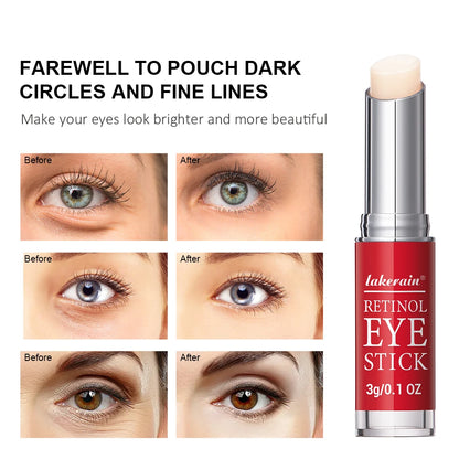 Lakerain Anti-Aging Retinol Eye Cream Stick – Anti-Wrinkle, Dark Circles & Eye Bag Removal