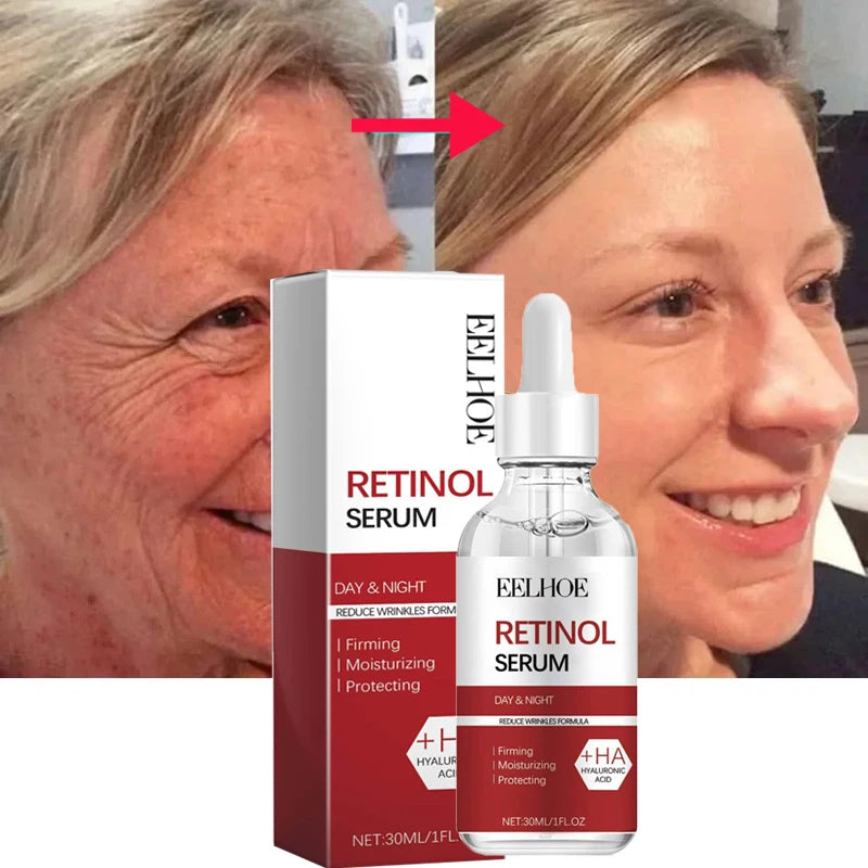 Retinol Anti-Aging Serum,  Eye Stick &  Wrinkle Repair Face Set  for a Youthful Look