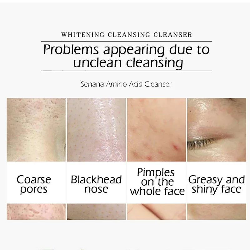 Nicotinamide Amino Acid Face Cleanser - Deep Cleansing , Shrink Pores & Oil Control for Clear Skin