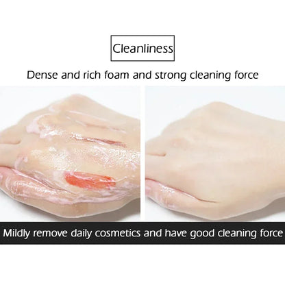 Nicotinamide Amino Acid Face Cleanser - Deep Cleansing , Shrink Pores & Oil Control for Clear Skin