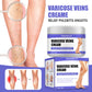 Effective Varicose Veins Relief Cream