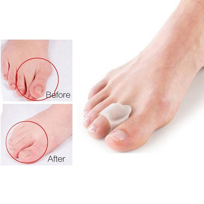 Silicone Toes Separator Bunion Bone Ectropion Adjuster