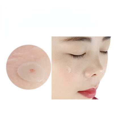 36pcs/set Hydrocolloid Acne Removal Patch