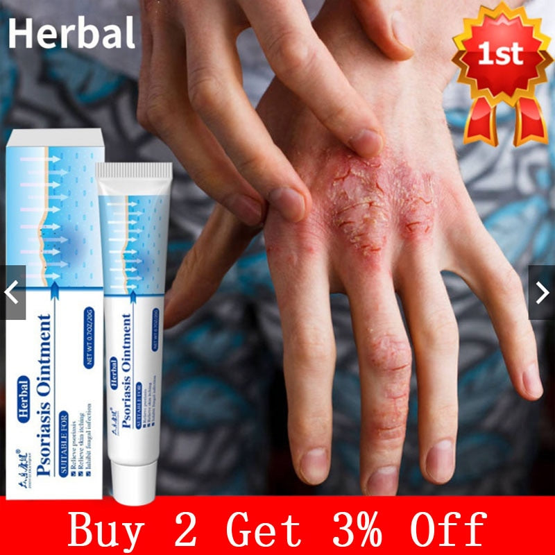 Antibacterial Psoriasis Herbal Cream