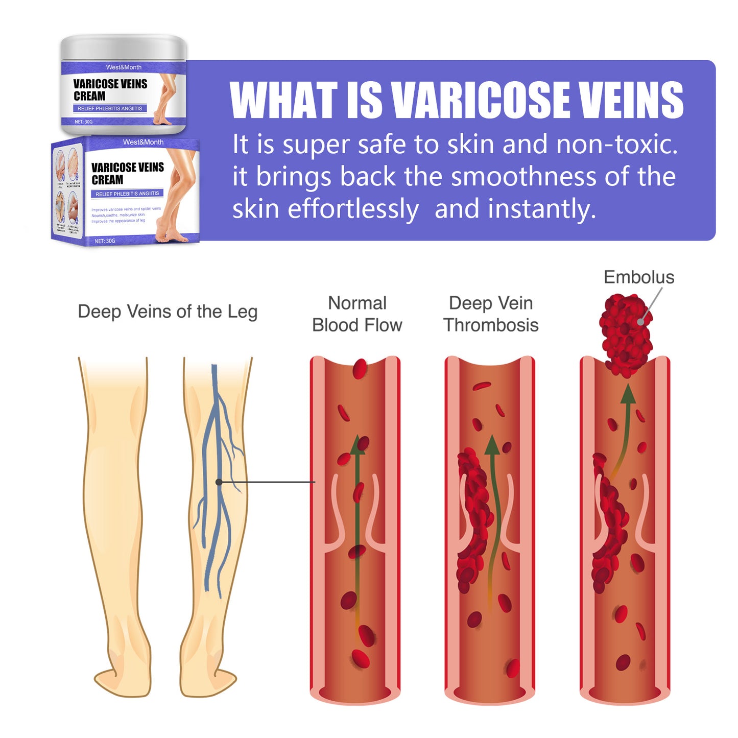 Effective Varicose Veins Relief Cream