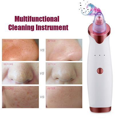 Blackhead Remover Vacuum