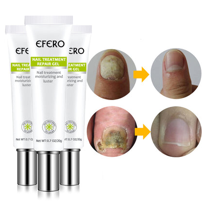 Fungal Nail Serum Repair Essence