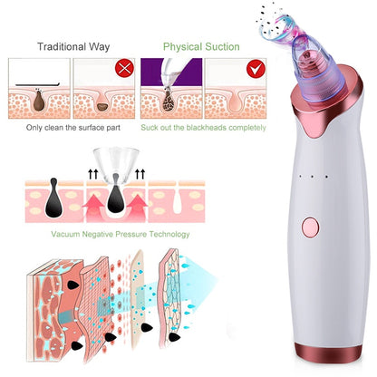 Blackhead Remover Vacuum