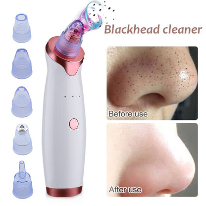 Blackhead Remover Vacuum