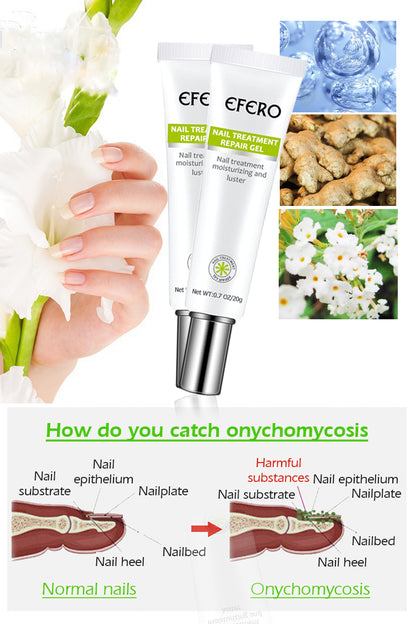 Fungal Nail Serum Repair Essence