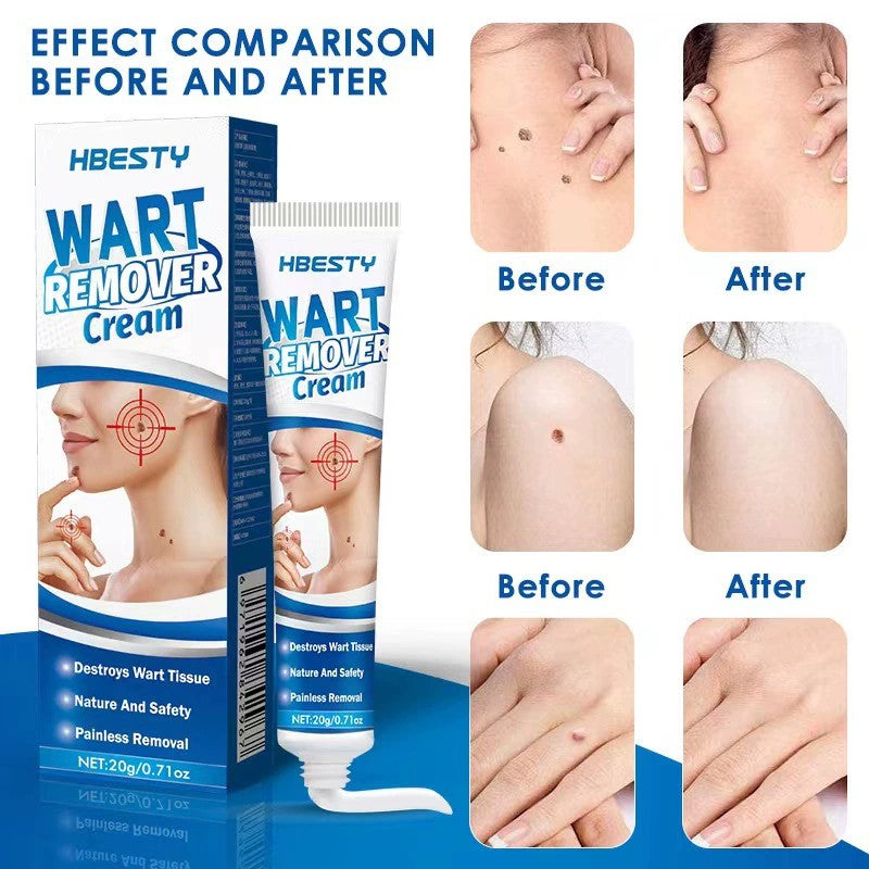 Skin Tag Remover Cream