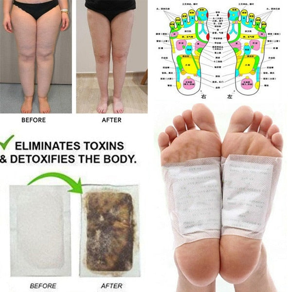 Detox Foot Patches 10 Pcs/Set