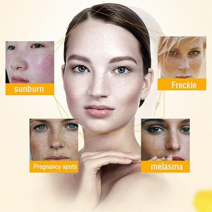 Whitening Freckle Cream