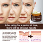 Retinol Wrinkles Removal Cream