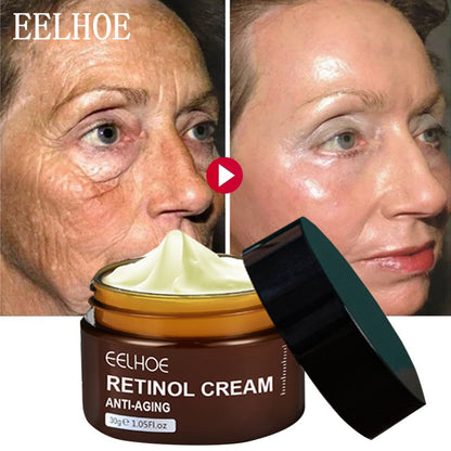 Retinol Wrinkles Removal Cream