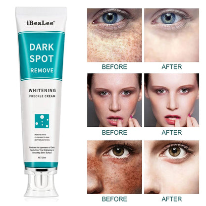 Dark Spot Removal Whitening Freckle Cream