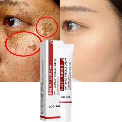 Whitening Freckle Cream