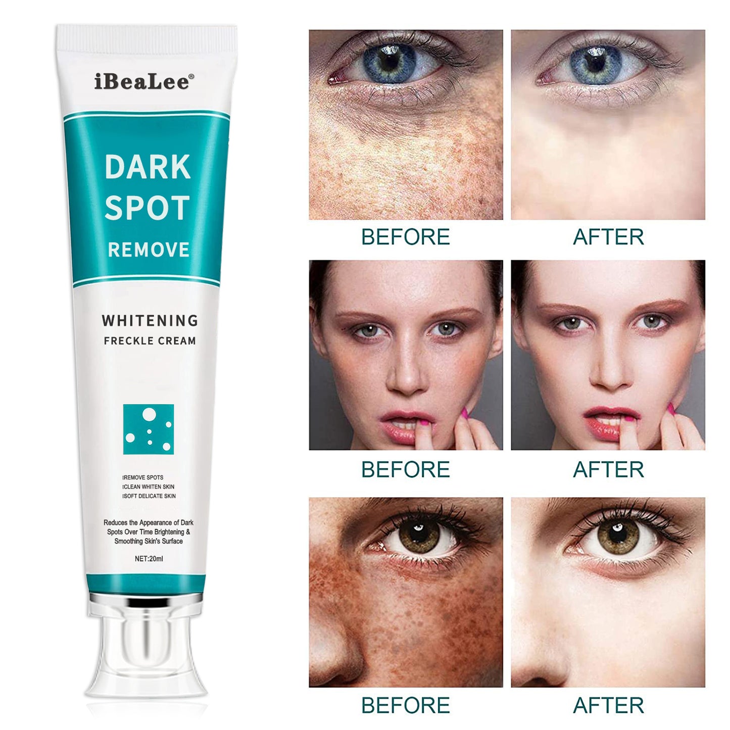 Dark Spot Removal Whitening Freckle Cream