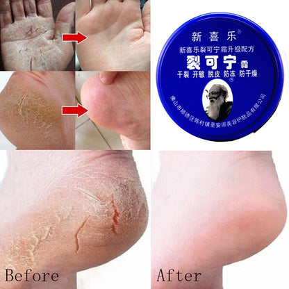 Herbal Anti Crack Foot Cream